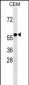 RNF31 Antibody (C-term)
